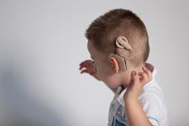 Cochlear Implant