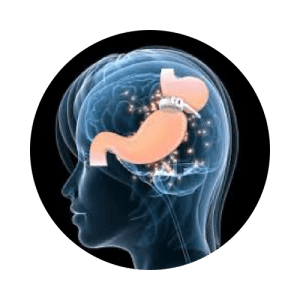 Hypno Gastric Band